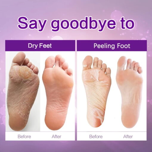 Exfoliating Foot Peel Mask - Image 4